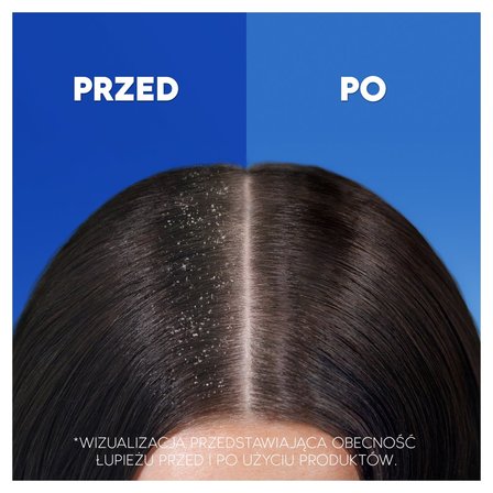 head & shoulders smooth & silky 2w1 szampon przeciwłupieżowy